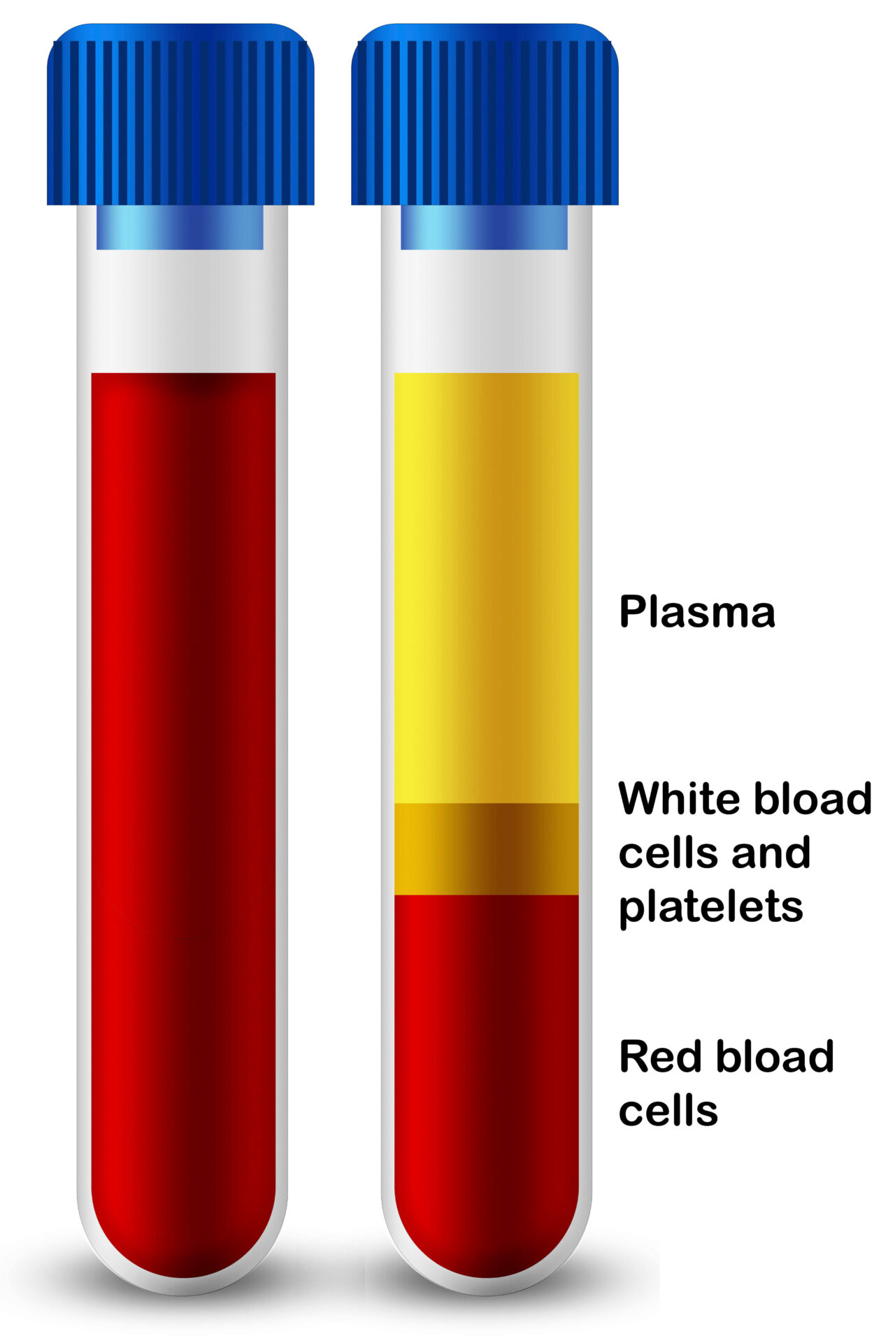 Blood Composition Of Platelets, Red Blood And White Blood Cells In Medical Test Tube